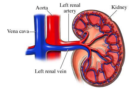 Some causes include: Acute tubular necrosis Glomerulonephritis Drugs/toxins Post-Renal A consequence of urinary tract