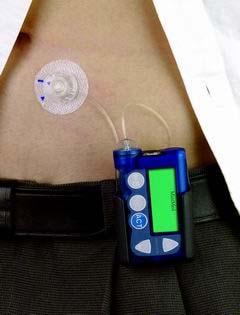 Insulin Pump Use Technically off-label use through pump Doses 100-600 units/day Not recommended for >600U/day