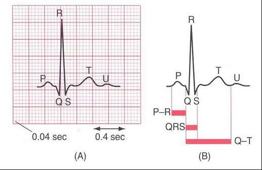 Analyzing the 12-Lead Where to start: Regularity Rate Evaluate waves and intervals P wave PR interval QRS T wave U wave