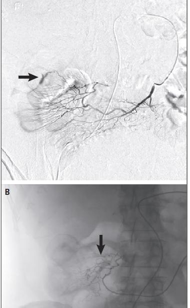Angiographic Diagnosis and
