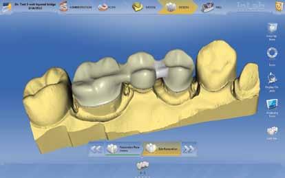 multi-tooth simultaneous design and work direct-on-tooth tools.