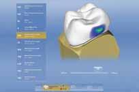 No matter what your dentists present you with, inlab software can do it
