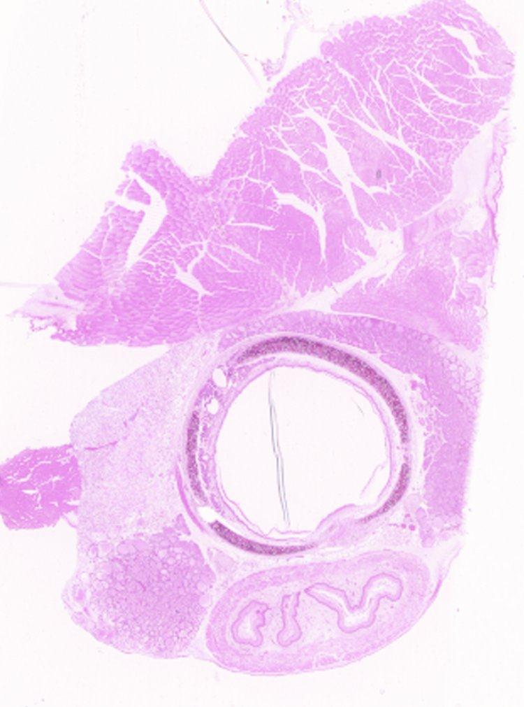 Trachea Identify the tracheal epithelium. Pseudostratified columnar epithelium.