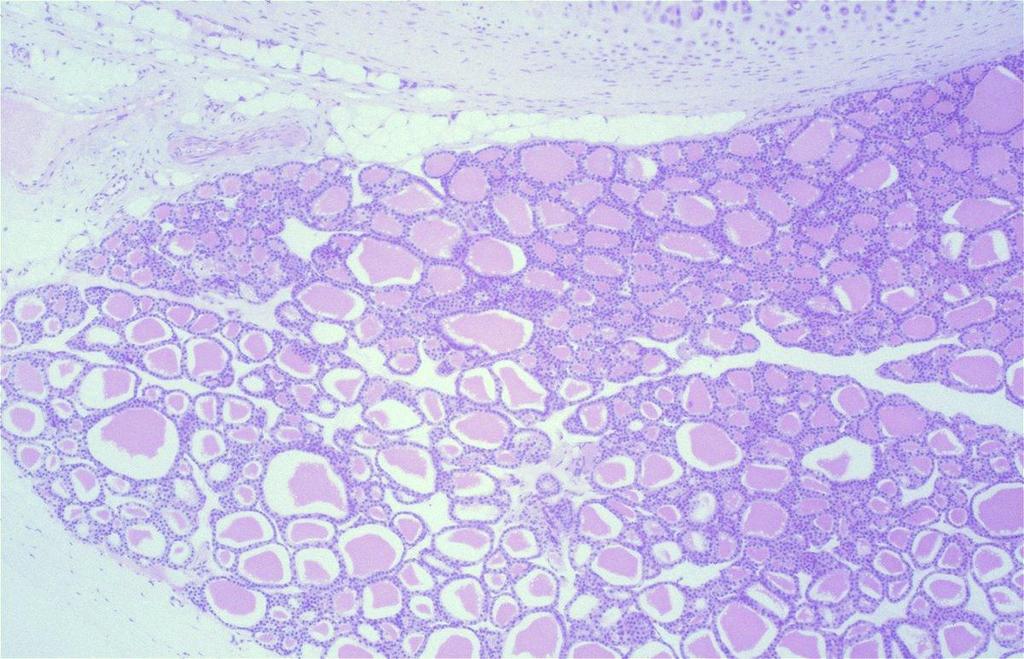 Thyroid gland In section 151 the gland is seen as as a deeply staining mass adjacent to the wall