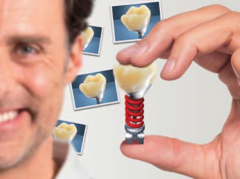 Precision Solutions Implant Crown