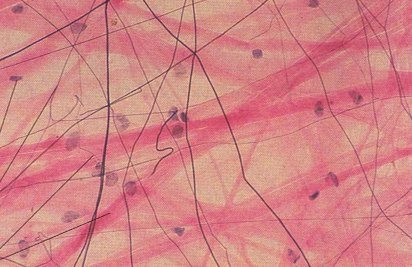 Areolar (Loose) Connective Tissue (x100) Collagen fiber (pink) Location: Around organs
