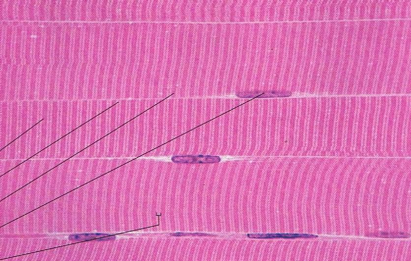 Skeletal (Striated) Muscle (x250) One Muscle Cell
