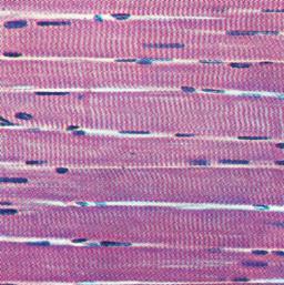 Which of the four basic tissue types is this?