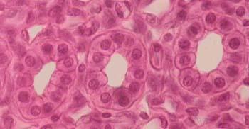 Which of the four basic tissue types is this?