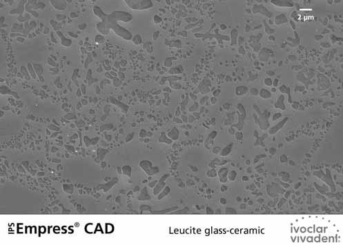 Leucite crystals of few microns evenly grow in a multi-stage process directly from the amorphous glass phase.