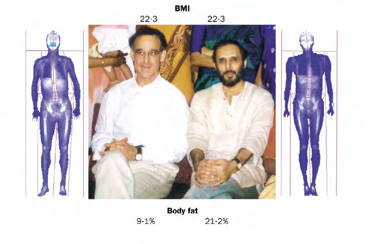 BMI and Body Fat European South Asian DXA scan of two individuals with the
