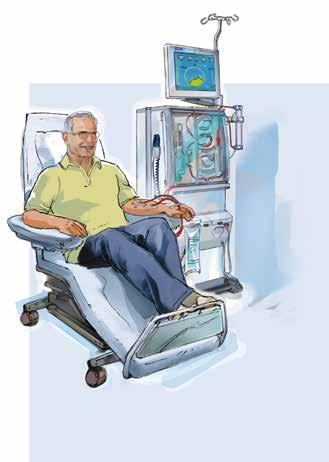 Haemodialysis (HD) treatment How is haemodialysis done? A dialyser is a bundle of hollow fibres produced from a special material that allows water and waste products to pass through.