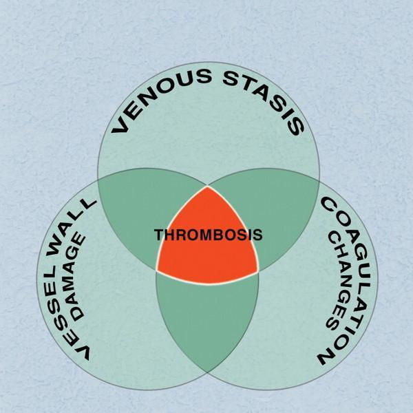 Virchow's Triad = 2 of these 3 conditions must be present for thrombosis to occur.