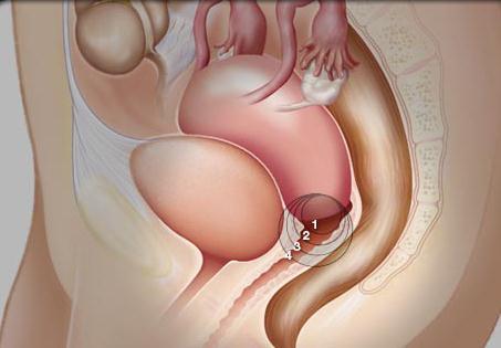 Cervix/Vulva/Vagina Based on Clinical Evaluation