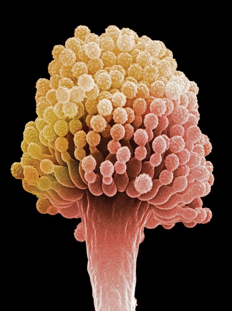 BY PATRICIA A. MURPHY, Ph.D., Suzanne Hendrich, Ph.D., and Cindy Landgren, Ph.D., D.V.M. Aspergillus conidiophore and spores, scanning electron micrograph at 8,000 magnification.