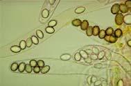 Sexual spores of Basidiomycota and Ascomycota A Few Words About