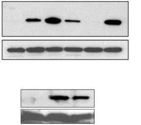 For detection of ATF-4 nd CHOP, immunolots were performed on nucler extrcts. Lmin B ws used s loding control.