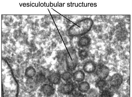 Vesiculotubular Structures Summary ER is an organelle acting in membrane biogenesis and intracellular