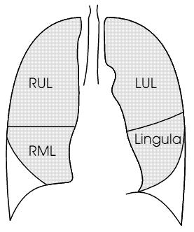 Lung Anatomy on Chest X-ray