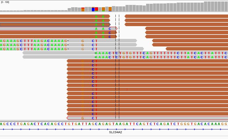 Translocations are called by Manta software; calls structural variants (SVs) and indels from mapped