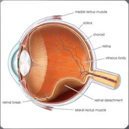 have improved since onset Treatment: r/o retinal break or hemorrhage, educate patient about symptoms of RD,