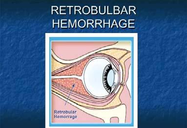 stretching of the optic nerve and blockage of ocular perfusion Result of orbital trauma Diagnosis: severe pain,