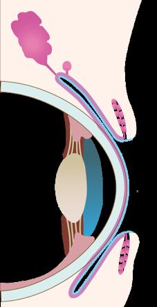 The ocular surface Main lacrimal gland Epithelium