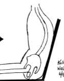 KYPHOSIS Intervention Strategies Address underlying posterior pelvic tilt: Accommodate hip and knee ROM limitations Adjust primary seating dimensions, especially seat depth Address sliding, tone,