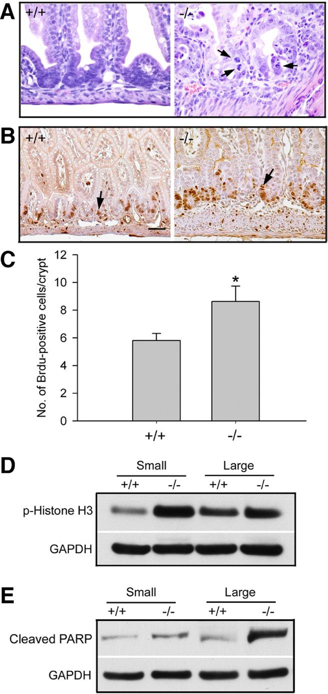 308 DING ET AL GASTROENTEROLOGY Vol. 142, No. 2 same time, cell apoptosis was also increased in Cldn7 / intestines, as indicated by the stronger anti-cleaved PARP signal (Figure 2E).