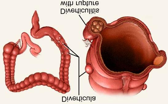 Rectum Last section of colon (large intestines) eliminate feces undigested materials extracellular waste Tell