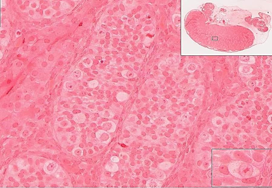 163 Fetal testis #19760 (UT163) Gonocytes Gonocytes of the fetal testis give rise to