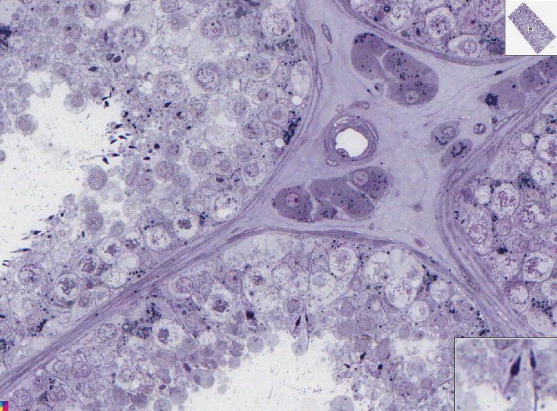 Human testis toluidine blue 19680 Seminiferous tubules Seminiferous epithelium Leydig cells Spermatozoa are produced in the seminiferous