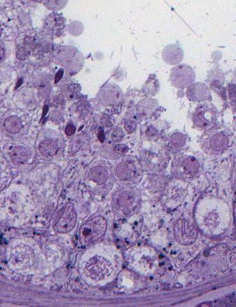 epithelium: Sertoli cells and germ cells: Sertoli