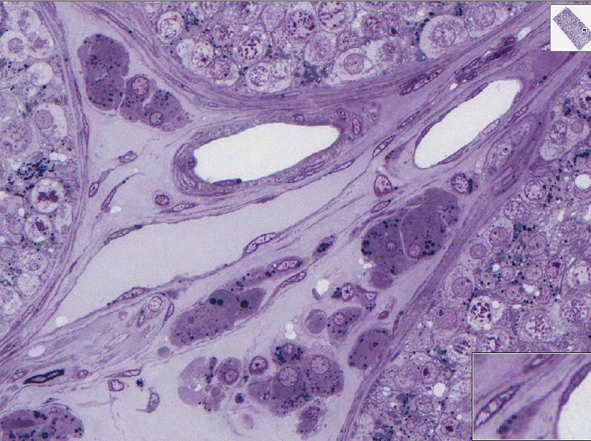 Testicular interstitium Primary spermatocytes Sertoli cell nucleus 19680 Myoid cells Fibroblasts, Lipid droplets in