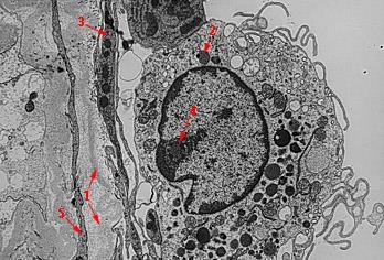 Aged rat testis EM 8h: macrophage in