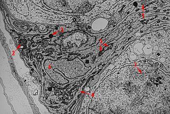 EM 19c; sertoli cell; 13 300x 1. Golgi 2.