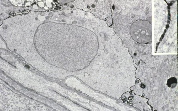 cells in seminiferous tubules