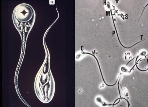 Epididymal Sperm