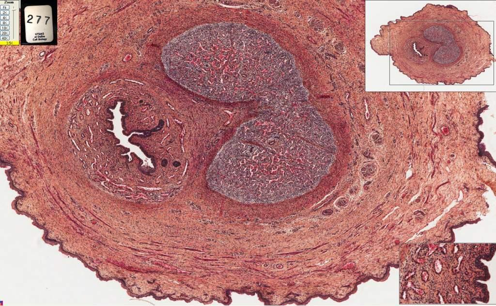 277 Penis transitional epithelium and surrounding spongy cavernous of