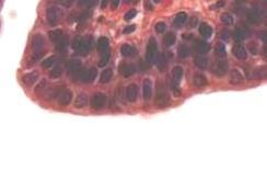 Transitional epithelium Spongy cavernous Dense connective tissue bands