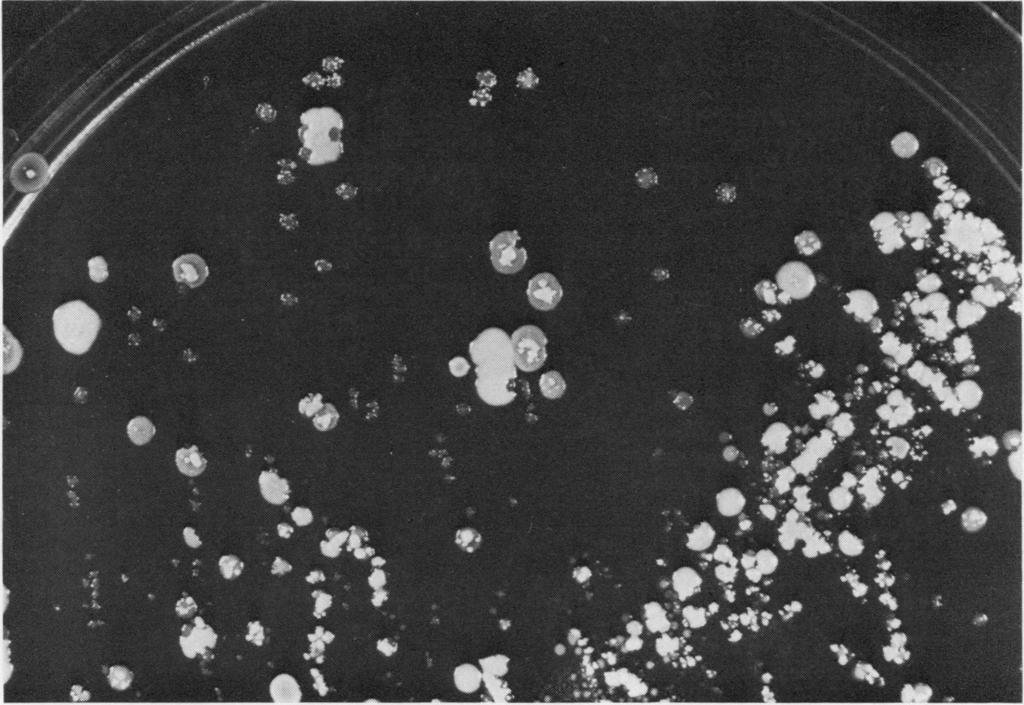 Isolation of Staphylococcus aureus from sputum in cystic fibrosis 917 --r~~~~~~~~~~~~~~~~~~~.1 Fig. 3 Pure culture of Staph. aureus from sputum, on blood agar, showing varied colonial forms x (approx.