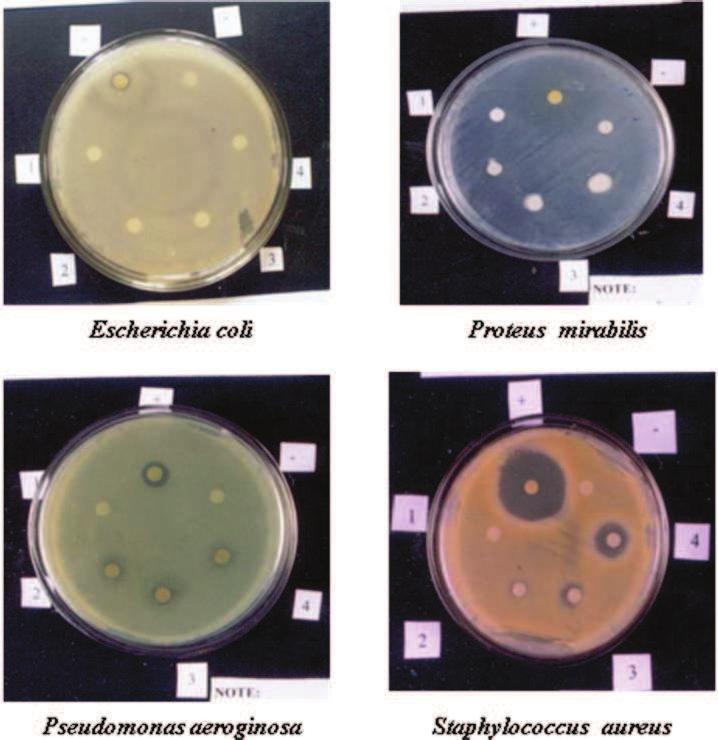 Plate 7 Antibacterial activity of Oscillatoria formosa against clinical pathogens Escherichia coli Proteus mirabis Pseudomonas aeroginosa Staphylococcus aureus + Positive control