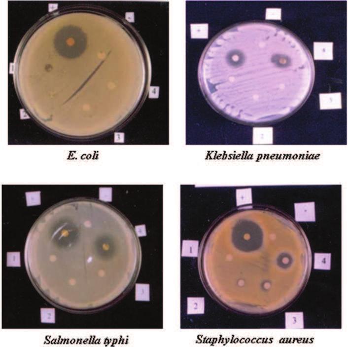 Plate 8 Antibacterial activity of Phormidium valderianum against clinical pathogens Escherichia coli Klebsiella pneumoniae Salmonella typhi Staphylococcus aureus + Positive control