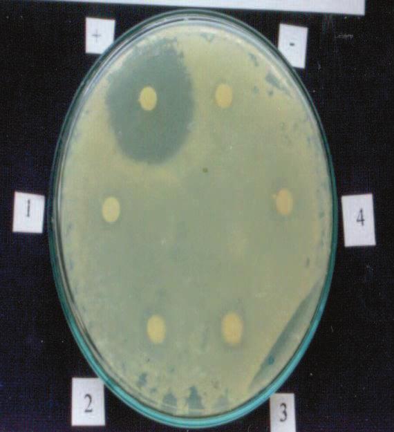 pneumoniae Proteus mirabilis Staphylococcus aureus +