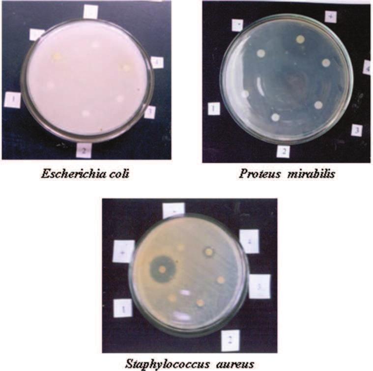 Plate 1 Antibacterial activity of Spirulina subsalsa against clinical pathogens Escherichia coli Proteus mirabilis Salmonella typhi + Positive control - Tetracycline