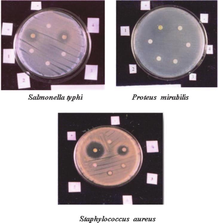 Plate 11 Antibacterial activity of Synechocystis pelvalikii against clinical pathogens Salmonella typhi Proteus mirabilis Staphylococcus aureus + Positive control -