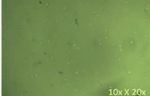 Human PBMC viewed under light microscope