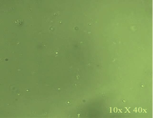 Human PBMC viewed under light microscope