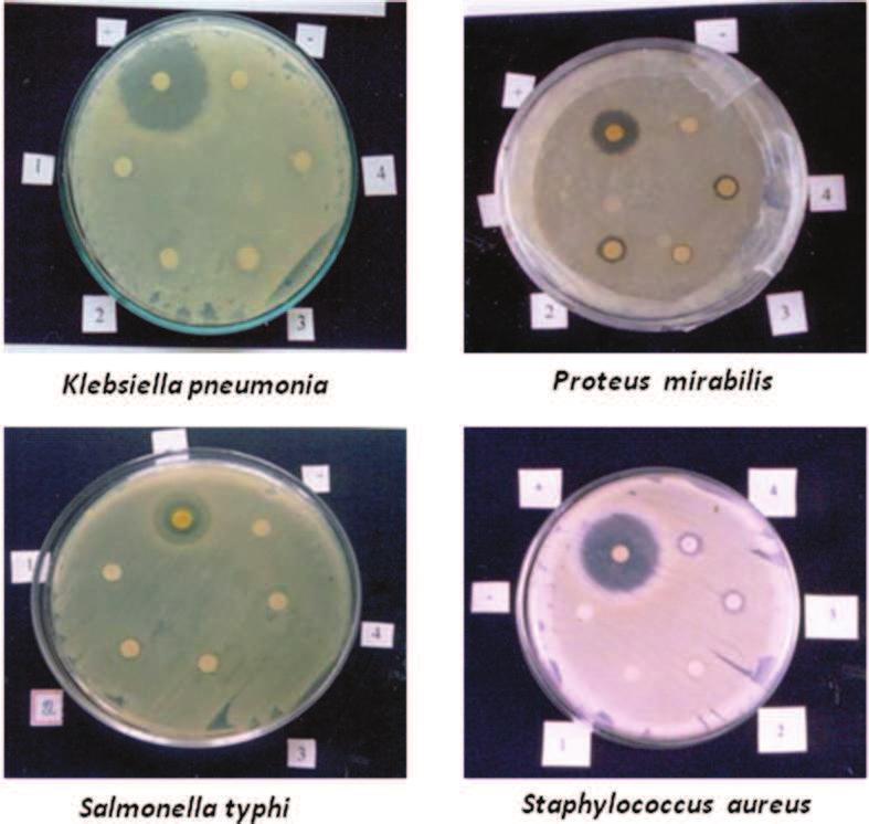 Plate 3 Antibacterial activity of Oscillatoria laete-virens against clinical pathogens Klebsiella pneumoniae Proteus mirabilis Salmonella typhi Staphylococcus aureus + Positive