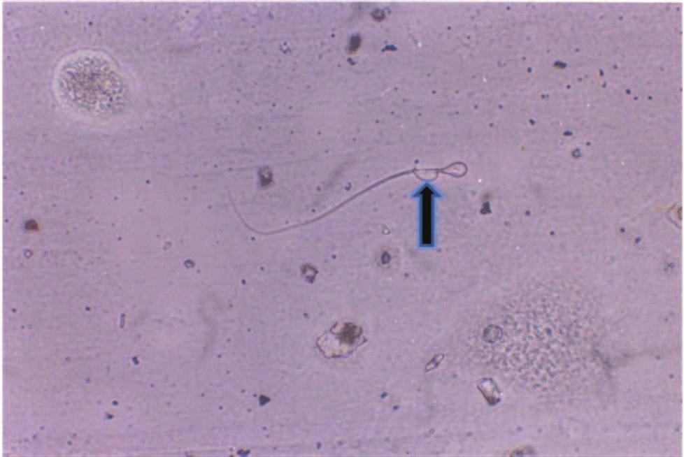 Plate 19: Sperm Abnormalities i.